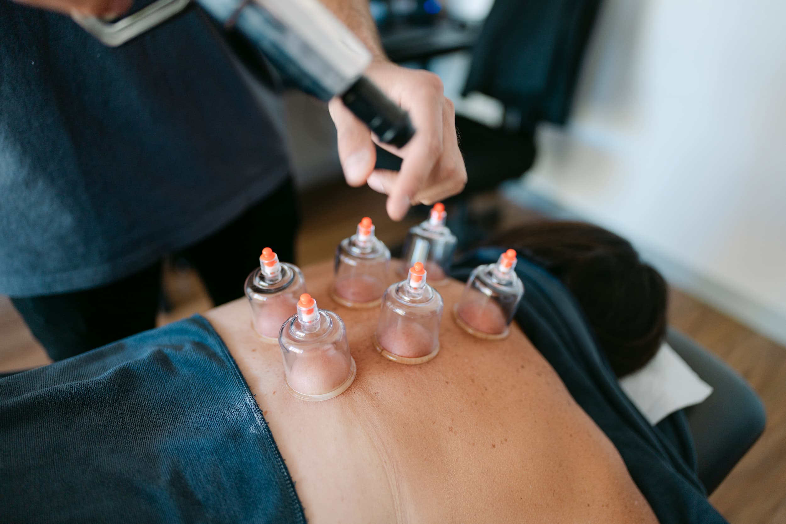 Close-up of Live Well practitioner using pump to apply cupping therapy to patient's back