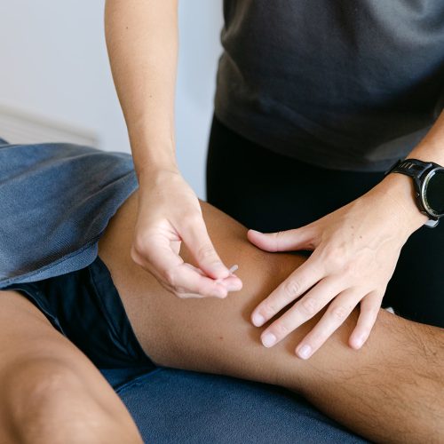 Dry Needling Caroline Springs Dry Needling Caroline Springs