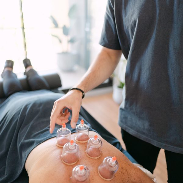 Live Well practitioner placing cupping therapy suction cups on patient's lower back in clinic