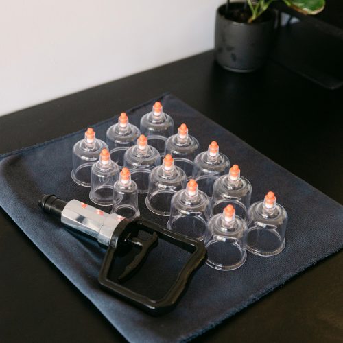 Cupping Therapy Equipment – Live Well Health Centre Cupping therapy set with suction cups and pump tool on desk at Live Well Health Centre